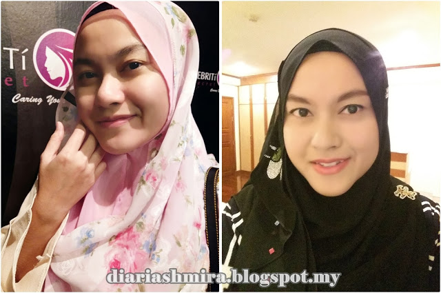 TESTIMONI CANTIK PERSIS CELEBRITI SPA SHAH ALAM TESTIMONI CANTIK PERSIS CELEBRITI SPA SHAH ALAM