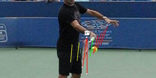RF+IZ+Pronation+003.jpg
