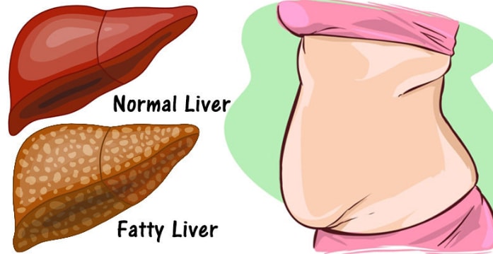 Signs Liver Is Full Of Toxins 