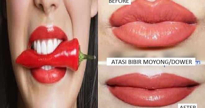 Tak Perlu Sulam Bibir'' Pria Maupun Wanita'' Inilah Cara