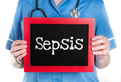 Hasil gambar untuk Tes cepat menemukan tanda-tanda sepsis dalam satu tetes darah