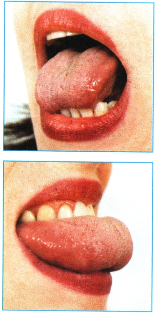 горки логопедические упражнения. упражнение чистим нижние зубки артикуляционная гимнастика. язык за зубами. артикуляционная гимнастика дует ветерок. почистим верхние зубки артикуляционная гимнастика.