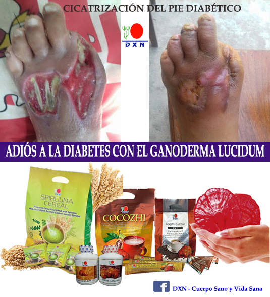 diabetes de cocozhi ganoderma