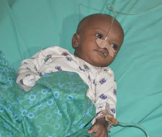 nigerian girl born with cleft lip