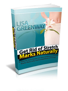 Stretch marks are narrow streaks or lines that railroad train on the surface of the skin