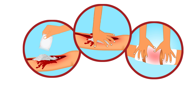 how to stop bleeding on a home remedies to stop bleeding in 60 seconds how to stop bleeding on a home remedies to stop bleeding in 60 seconds