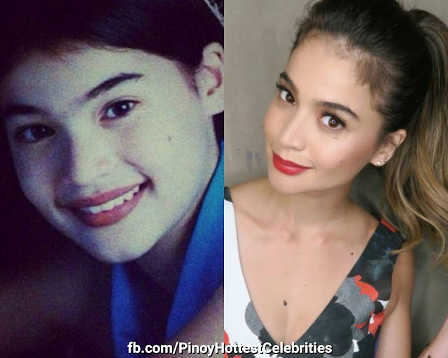21 Before And After Photos Of Filipino Celebrities
