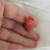 0.8 lb (362.9g)12-week Premature Baby Is The Smallest To Ever Make It