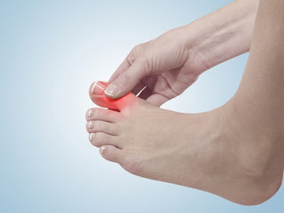 Biểu hiện cảnh báo viêm khớp ngón chân