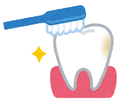 歯の磨き残しのイラスト