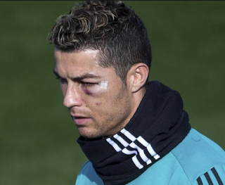 Cristiano Ronaldo Head Injury - Sport - I Love Football
