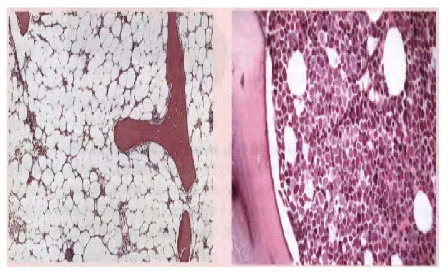 Aprendiendo Histología Médula Ósea