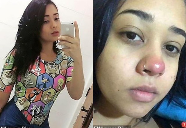 Layane Dias Mendadak Lumpuh Usai Menindik Hidung, Peringatan Keras Bagi Remaja