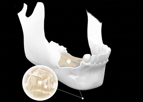 ĐÁNH GIÁ TIÊU CHUẨN CHẤT LƯỢNG XƯƠNG HÀM TRONG CẤY GHÉP IMPLANT -4