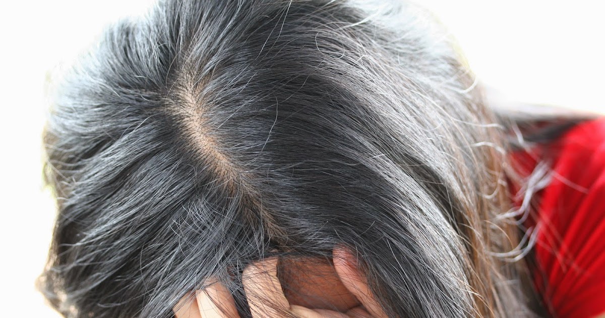 Поседела от стресса. Появился первый седой волос. Причины седых волос у детей 1 года. Ранняя Седина у подростков мальчиков частями.