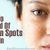 Get Rid of Age Spots With help of Home Remedies