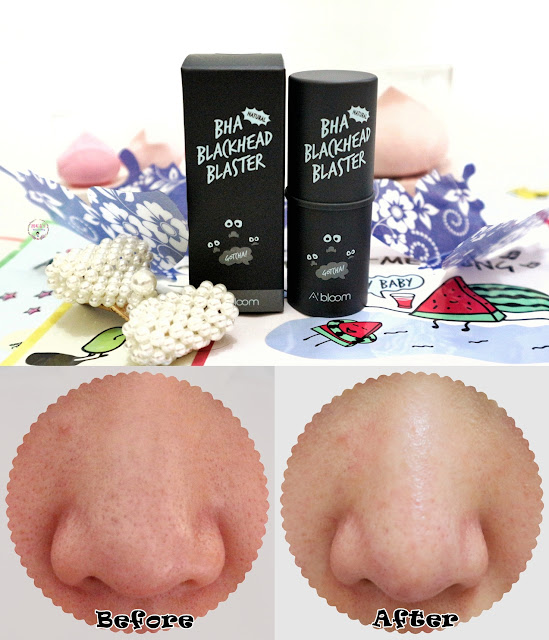 A'Bloom BHA Blackhead Blaster before-after