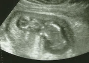 Baby 3rd picture