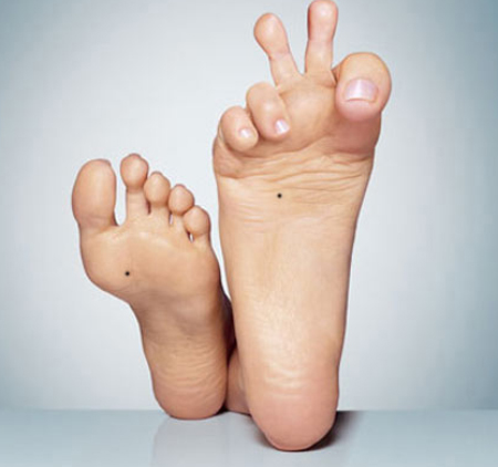 Nốt ruồi trong lòng bàn chân Nốt ruồi trong lòng bàn chân