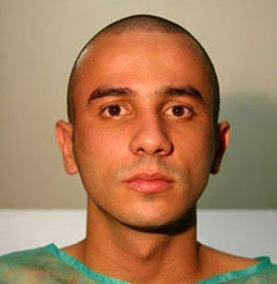 brazilian man dog face plastic surgery