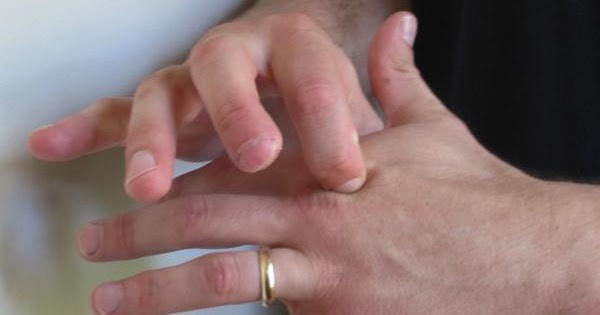 Левая рука безымянный палец. Указательный палец левой руки. Между указательным и среднем пальце. Между указательным и среднем пальце. Родинка на ладони левой руки.