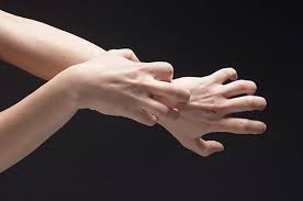 obat kadas kudis kurap tradisional: Obat kudis herbal