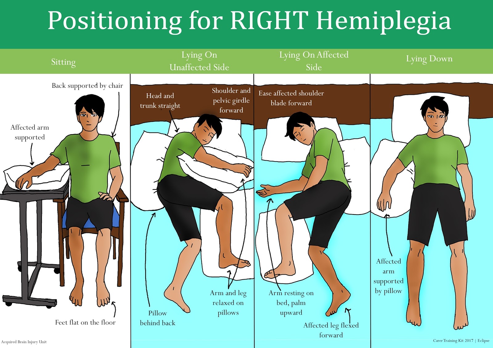 Carer Training Information Right Hemiplegia Positioning