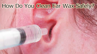 How Do You Clean Ear Wax Safely?