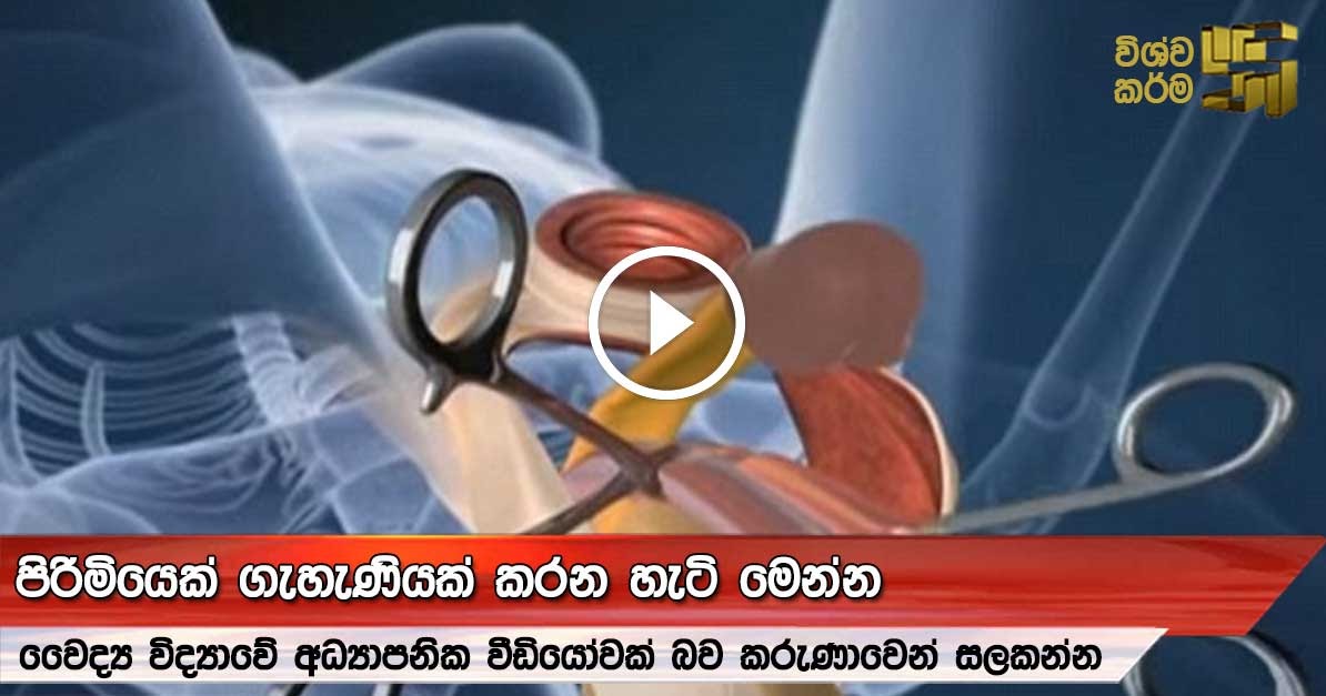 This Is How Gender Reassignment Actually Works Wishwa Karma