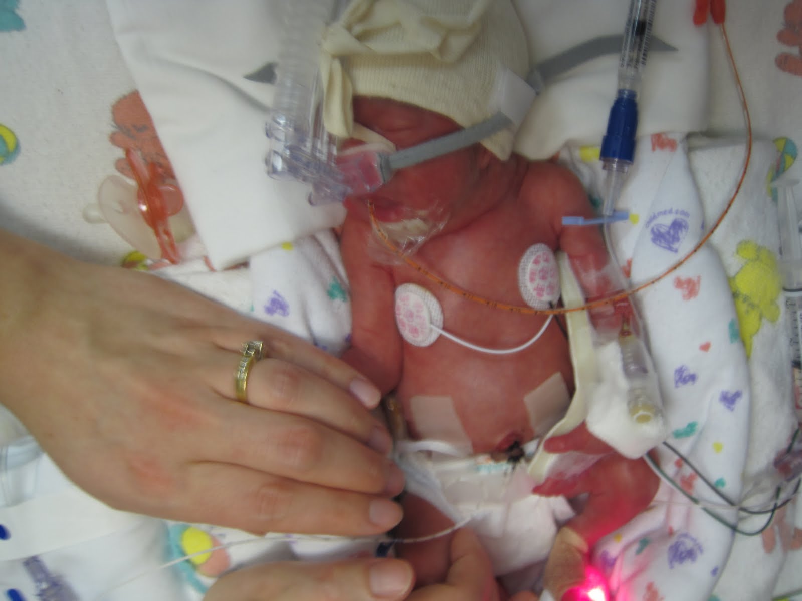 Born 30 weeks