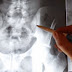 Preguntas y respuestas sobre la indemnización por un esguince cervical