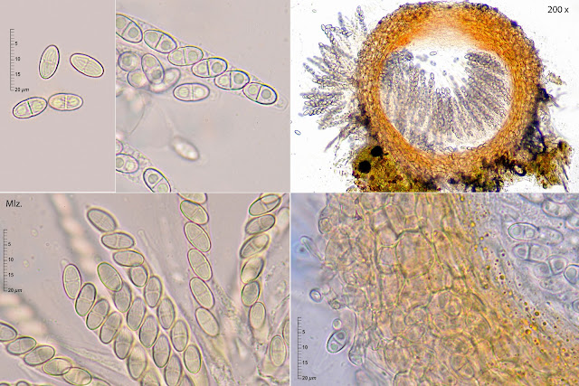Hydropisphaera peziza 