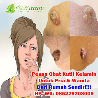 Obat Kutil Kelamin