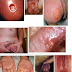 Obat Penis Perih Dan Panas Saat Kencing