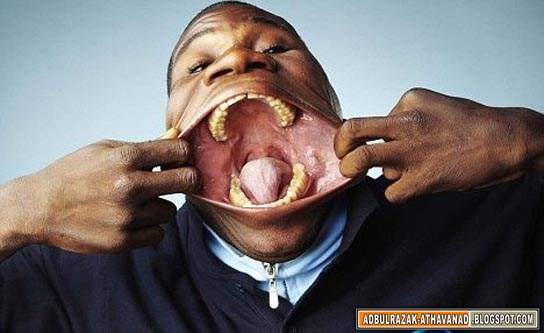 INFO WORLD: Worlds Biggest Mouth (Guinnes Record)