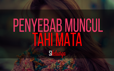 Apa Penyebab Muncul Belekan Pada Mata