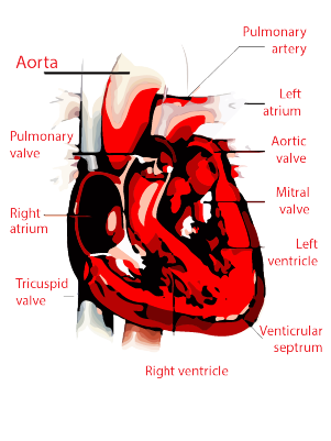 Pulmonary valve stenosis