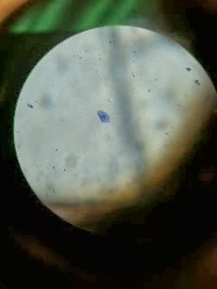 Microscopic Cheek Cell