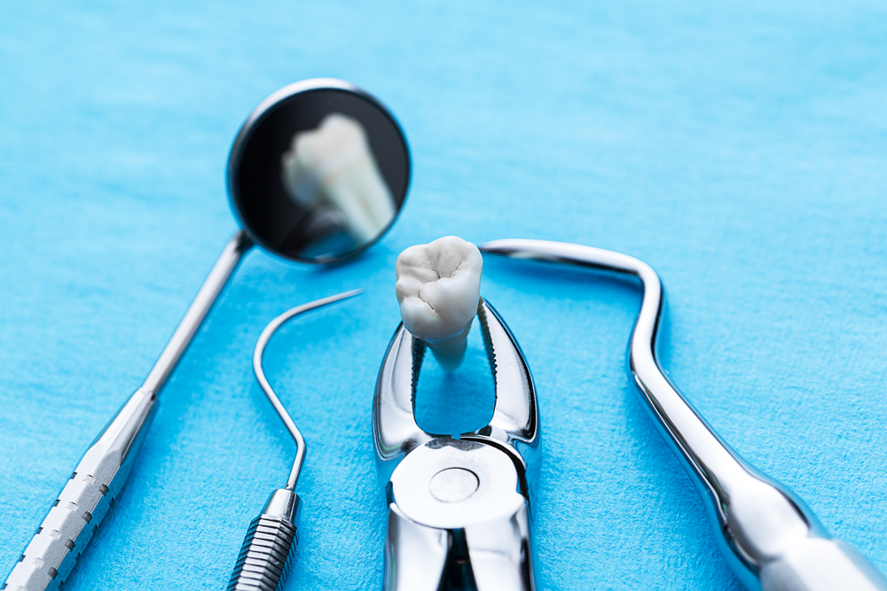 Traitement après extraction dentaire - Soins dentaires