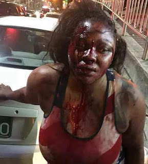  Young lady brutally beaten by her boyfriend in South Korea few week after their engagement (photos)