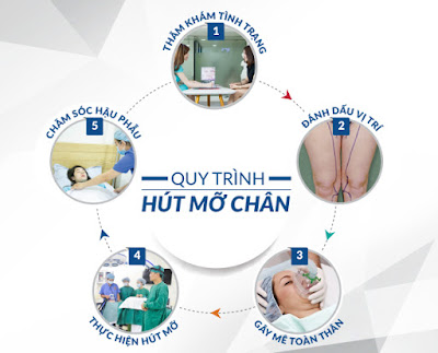 Hút mỡ đùi ở đâu tốt