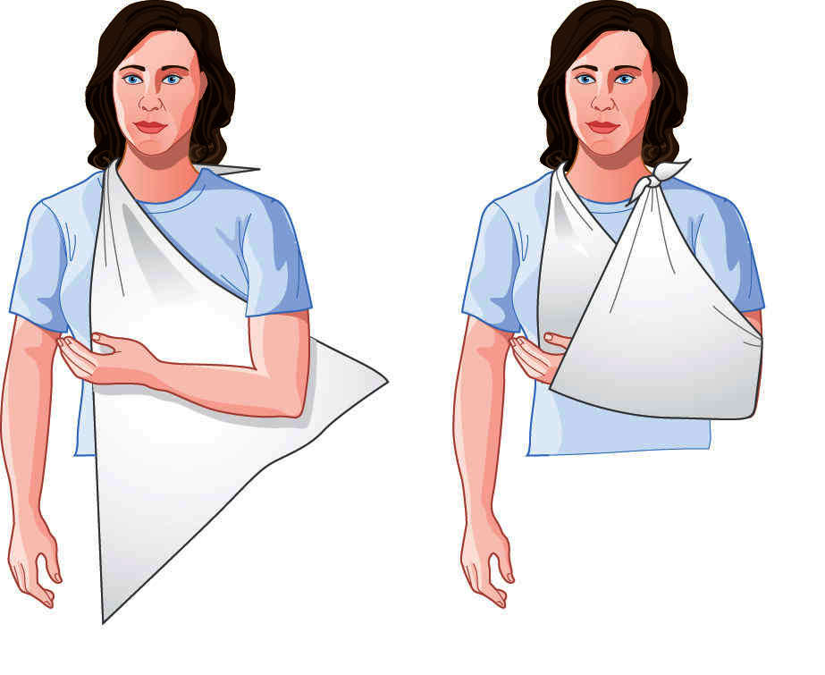 Medical Taber's Medical DictionaryBandage