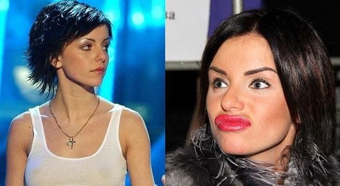 Бьянка Фото До Пластики – Telegraph