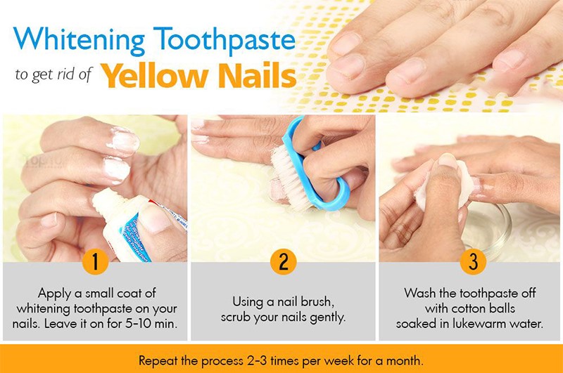 Get Rid Of Yellow Nails