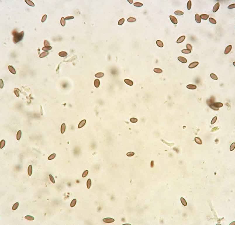 dark brown spores of Mycocalicium subtile