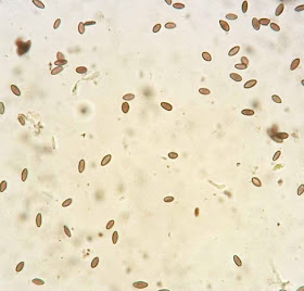 dark brown spores of Mycocalicium subtile