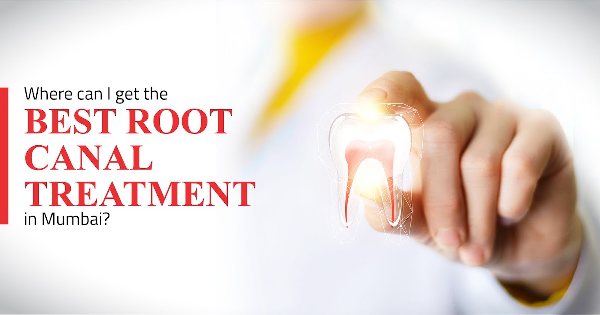 Where can I get the best root canal treatment in Mumbai? My Poll Ux