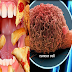 These Foods Make Cancer Cells Grown In Your Body Without Your Knowledge, Stop Eating Them Right Now!