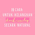 11 CARA UNTUK HILANGKAN DARK CIRCLES SECARA NATURALLY