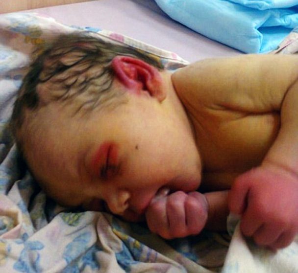 HEART-BREAKING! 3-day-old Abandoned Baby, Eaten alive by Ants in a Forest HEART-BREAKING! 3-day-old Abandoned Baby, Eaten alive by Ants in a Forest